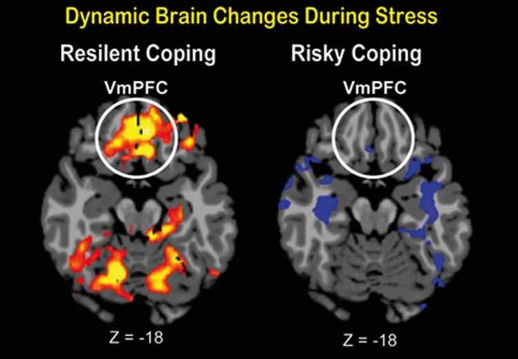 The Role of Neurotransmitters in Resilience